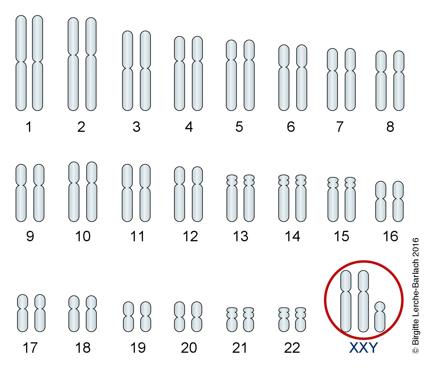 Klinefelters-kromosomer