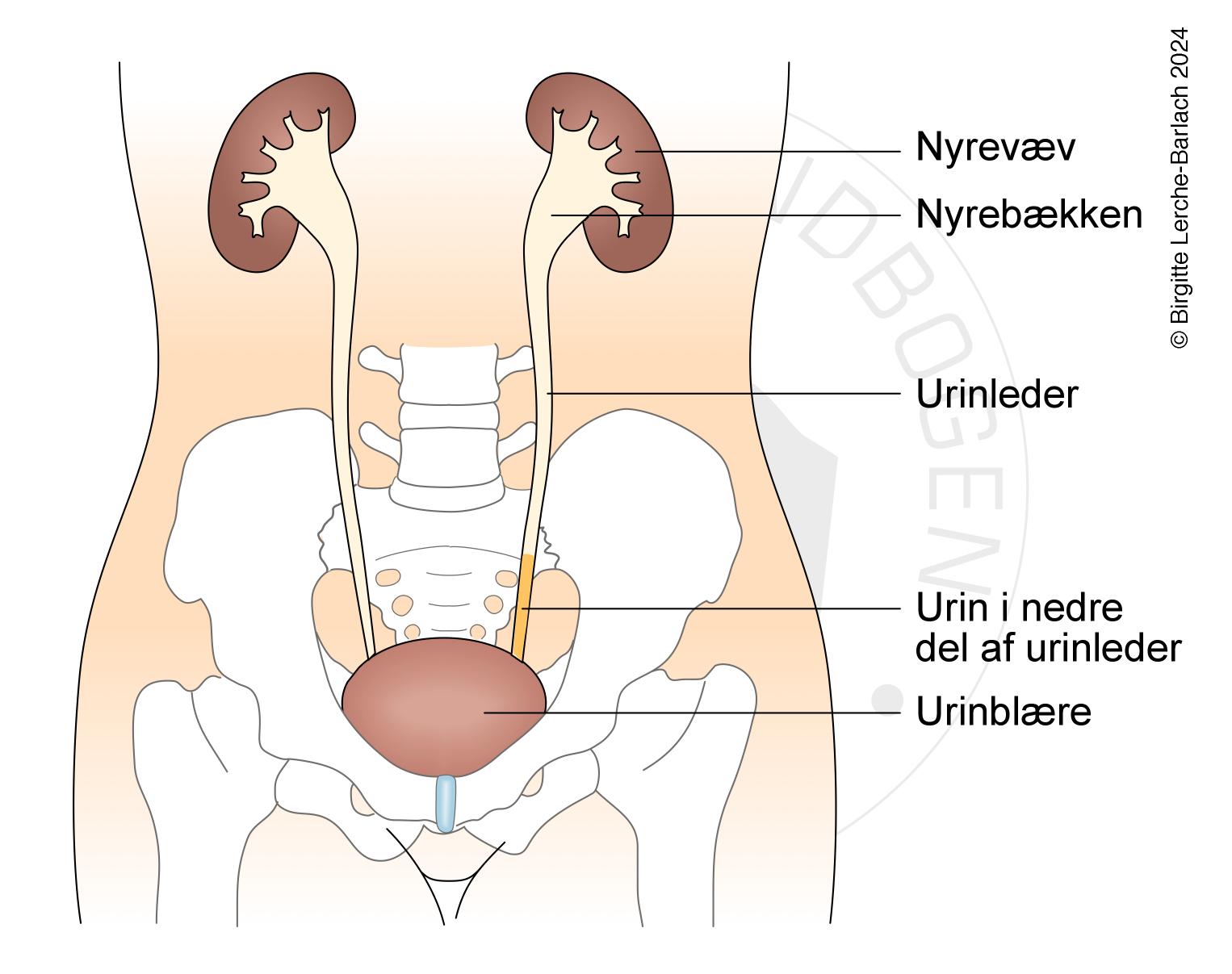 LH_509 Grad 1 refluks urin