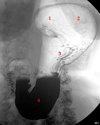 mavesaek-normal-staende roentgen