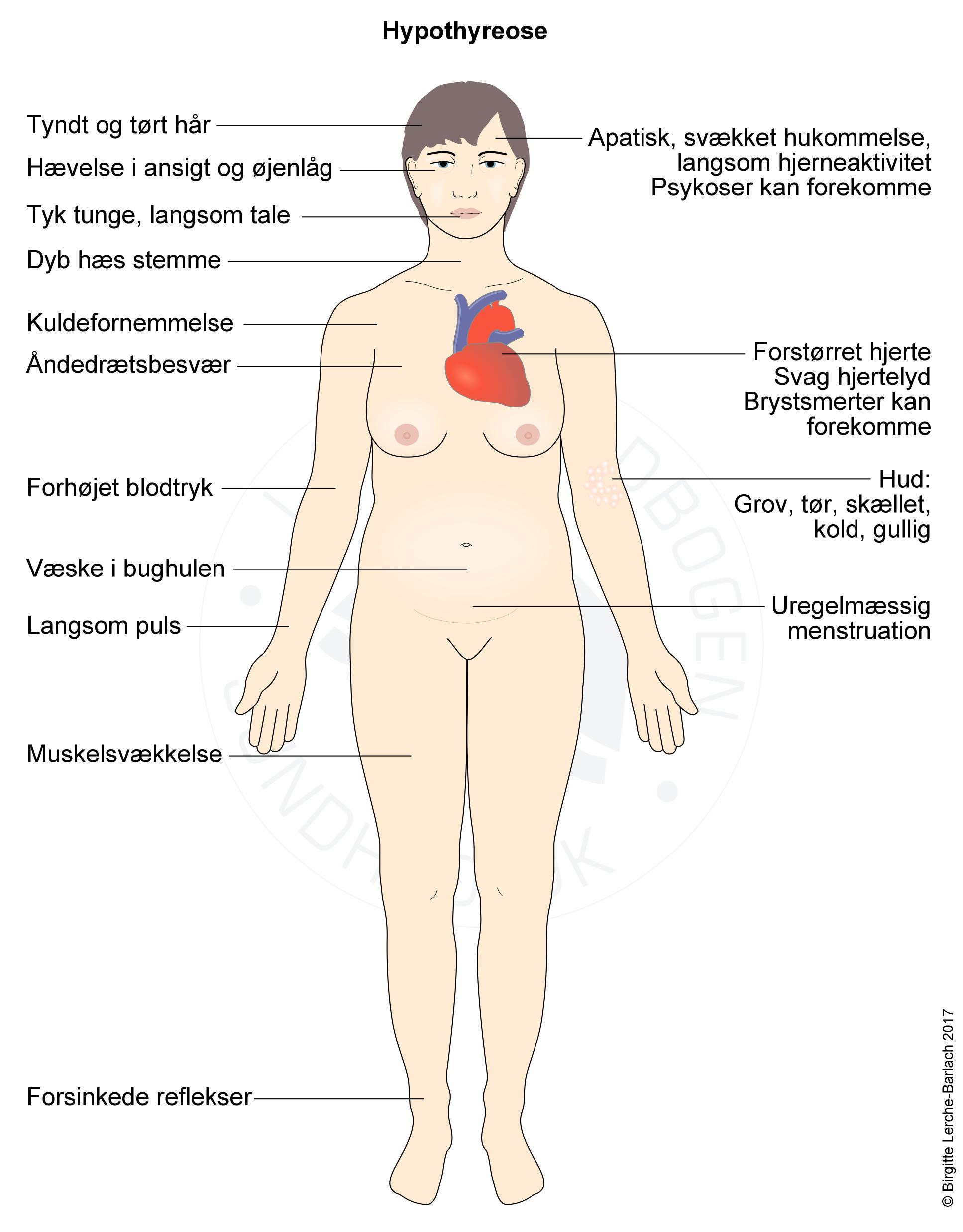 Symptomer ved hypothyreose