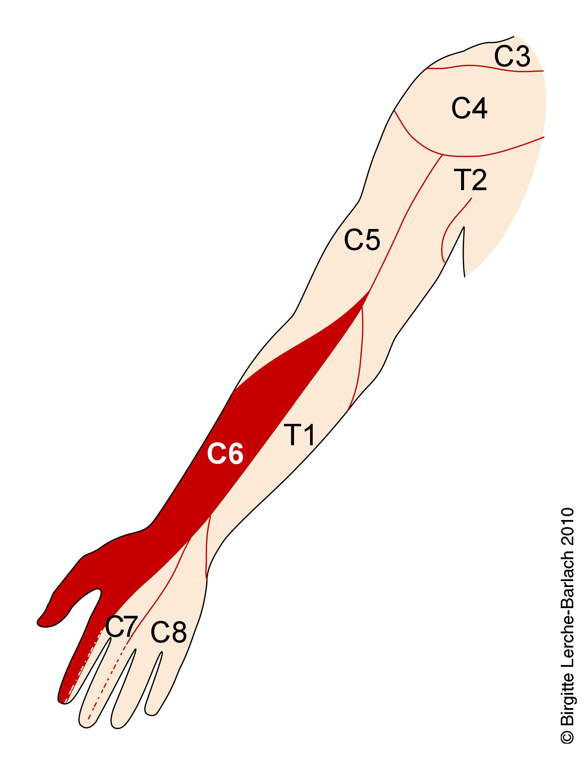 arm-dermatom c6
