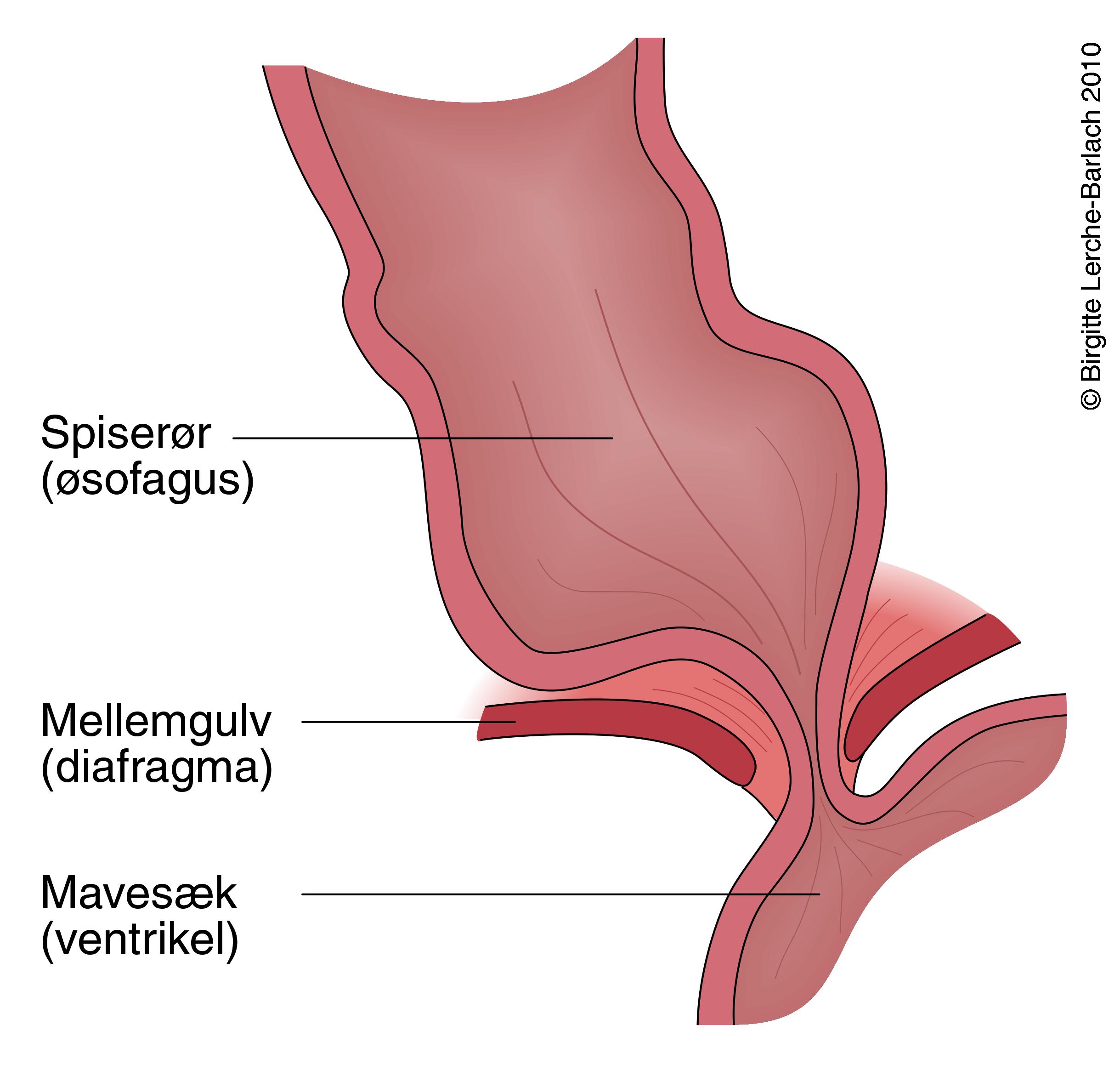 oesofagussfinkter-uden refluks