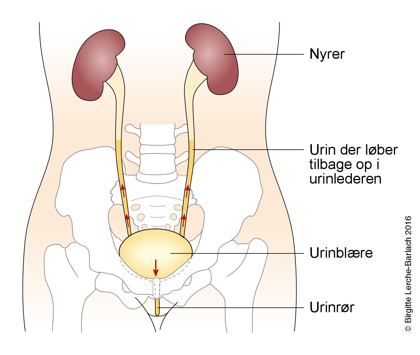 blaere-urinreflux