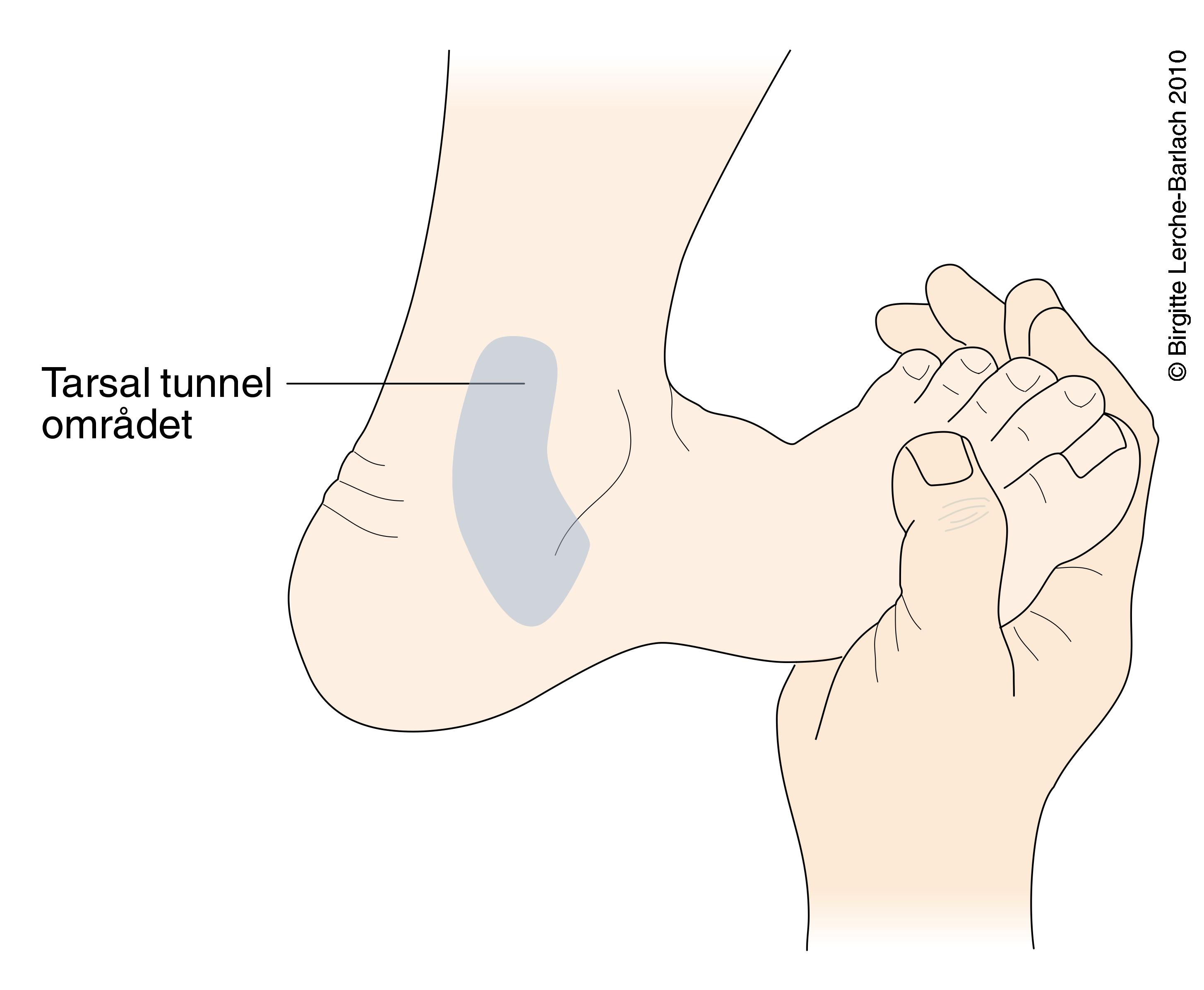 fod-tarsal tunnel test