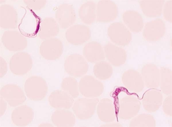 blodudstryg-trypanosoma parasit