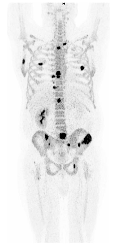 2023-08-18 Knogle-PET illustration