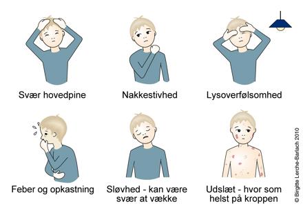 Symptomer på meningitis, tegning.
