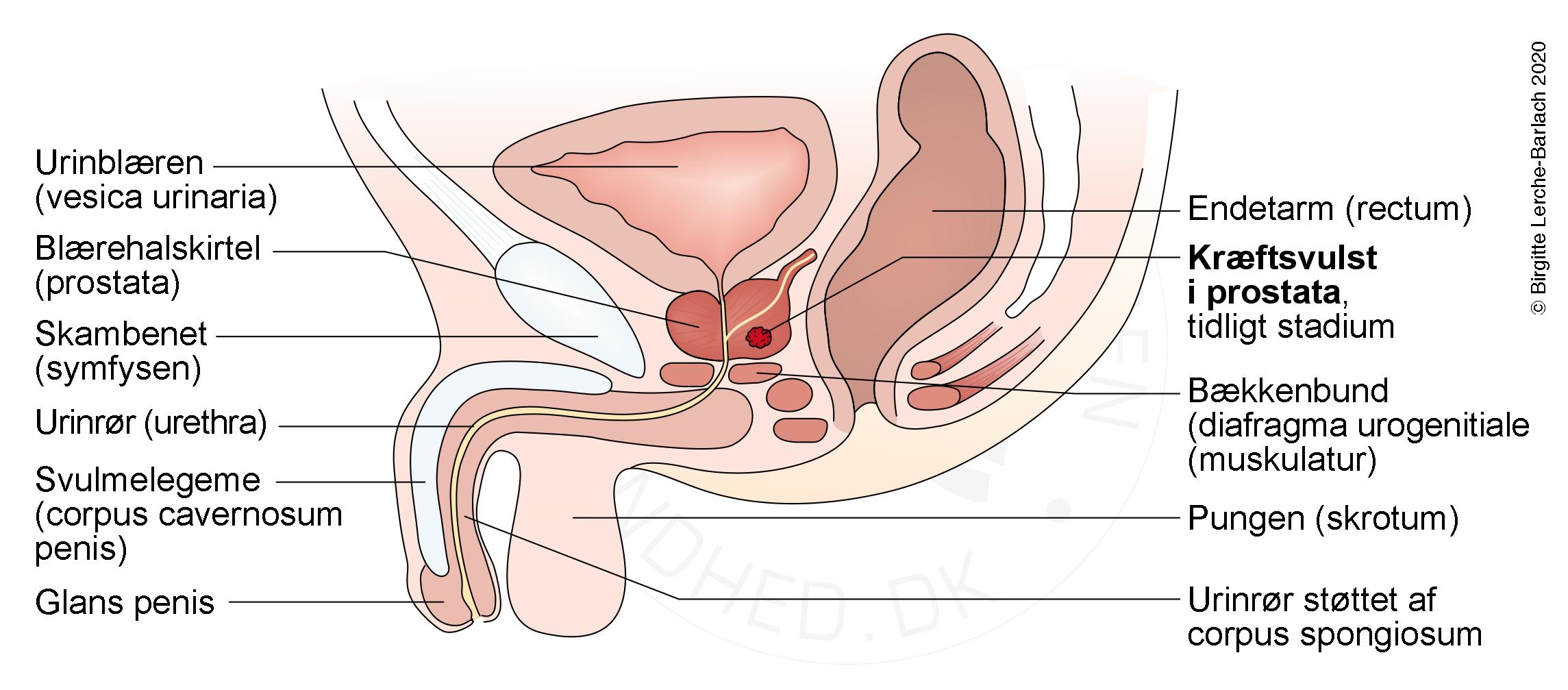 prostata kraeftknude