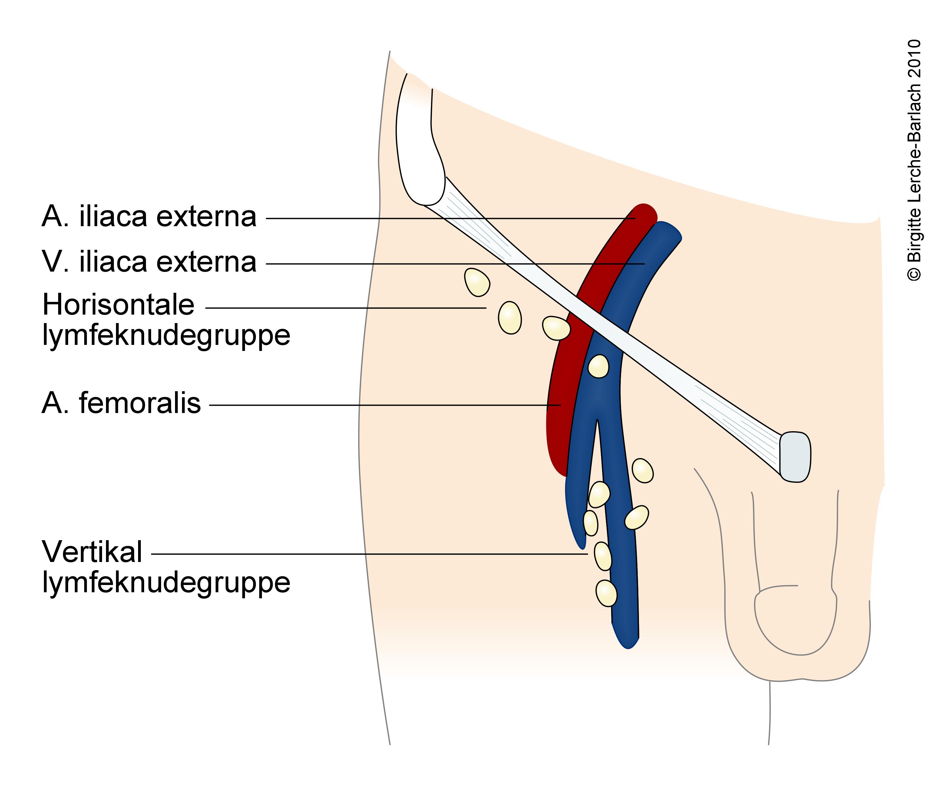 lymfe-lymfekirtler i lyske