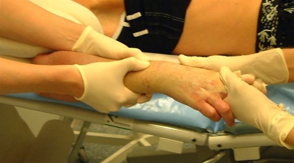 radius - fraktur - reponering