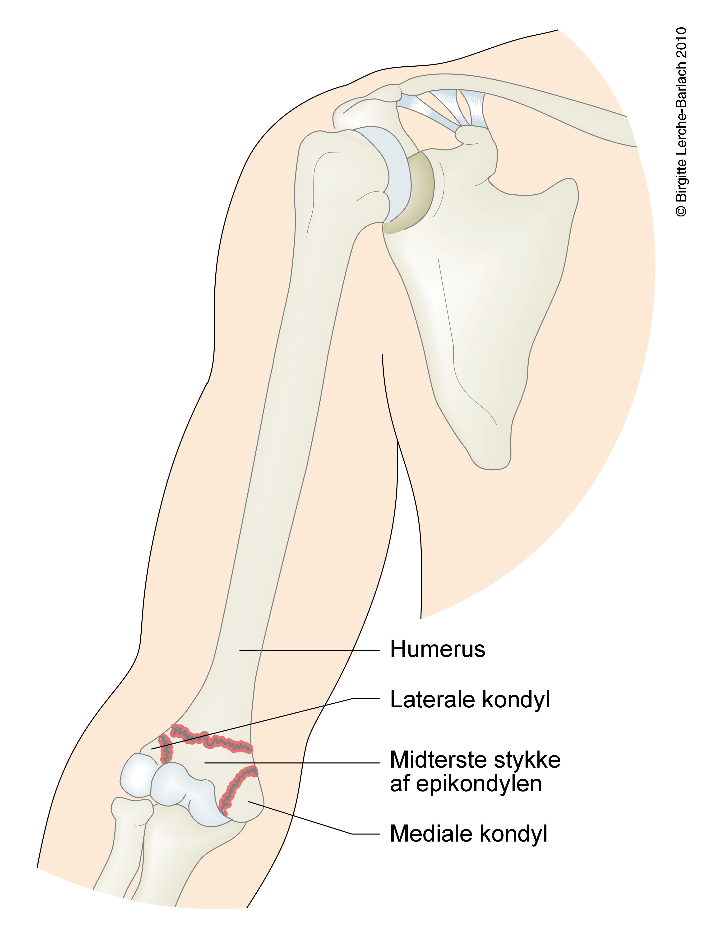overarm-fraktur transkondylaer humerus hele overarmen 7325