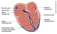 Syg sinus syndrom Patienth ndbogen P Sundhed dk Syg sinus syndrom Patienth ndbogen P Sundhed dk