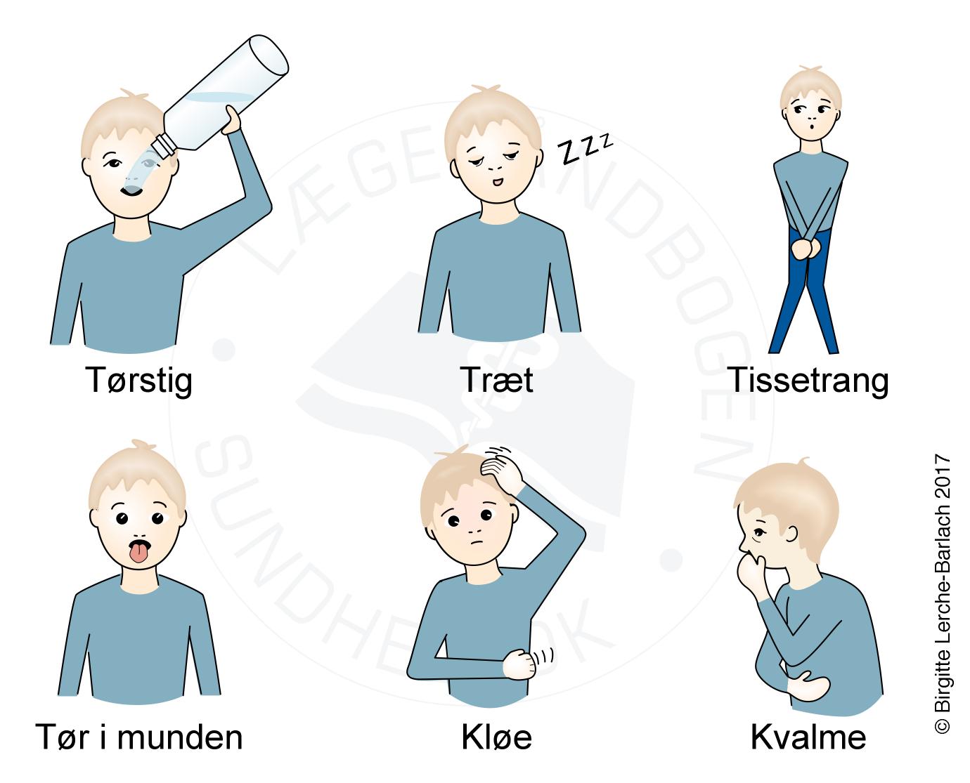 Hyperglykæmi type 2-diabetes (højt blodsukker) på