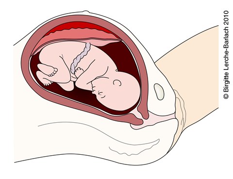 Gravid Skade Mod Maven Patienthandbogen Pa Sundhed Dk