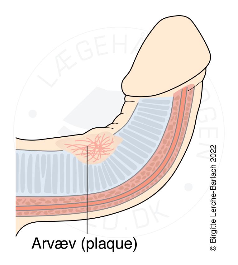 Mening sikimning surati